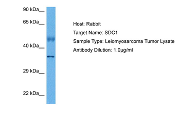 SDC1 Rabbit Polyclonal Antibody