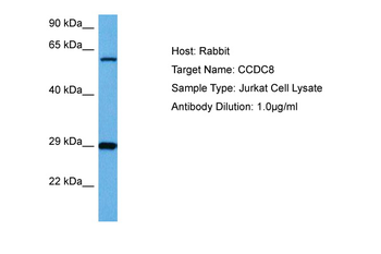 CCDC8 Rabbit Polyclonal Antibody