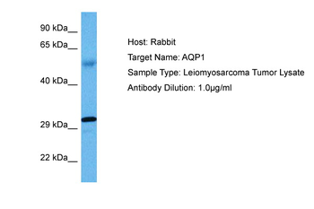 AQP1 Rabbit Polyclonal Antibody