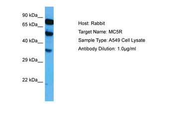 MC5R Rabbit Polyclonal Antibody