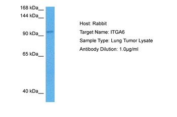 ITGA6 Rabbit Polyclonal Antibody