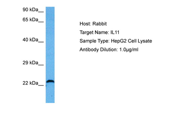 IL11 Rabbit Polyclonal Antibody