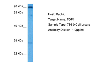 TOP1 Rabbit Polyclonal Antibody