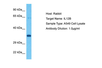 IL12B Rabbit Polyclonal Antibody