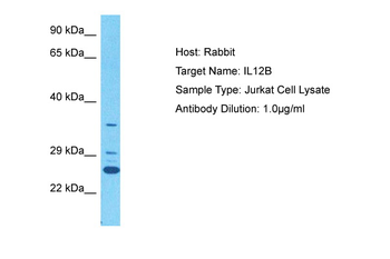 IL12B Rabbit Polyclonal Antibody