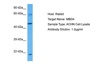 MBD4 Rabbit Polyclonal Antibody