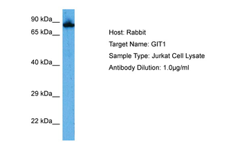 GIT1 Rabbit Polyclonal Antibody