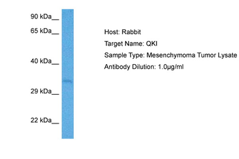 QKI Rabbit Polyclonal Antibody
