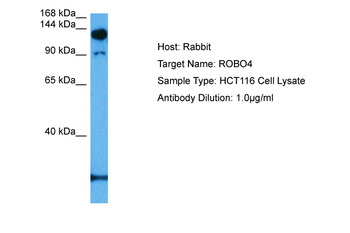 ROBO4 Rabbit Polyclonal Antibody