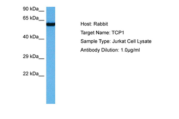 TCP1 Rabbit Polyclonal Antibody