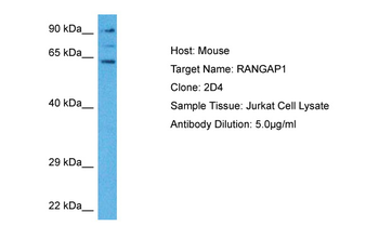 RANGAP1 Rabbit Polyclonal Antibody