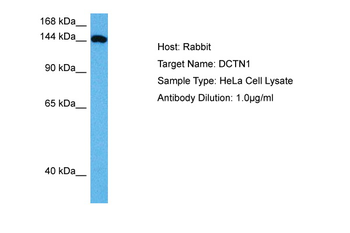 DCTN1 Rabbit Polyclonal Antibody