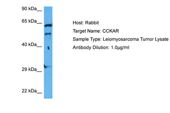 CCKAR Rabbit Polyclonal Antibody