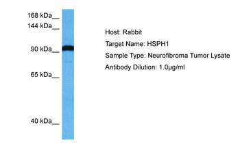 HSPH1 Rabbit Polyclonal Antibody