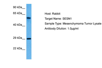 SESN1 Rabbit Polyclonal Antibody