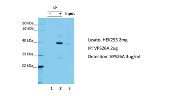 VPS26A Rabbit Polyclonal Antibody