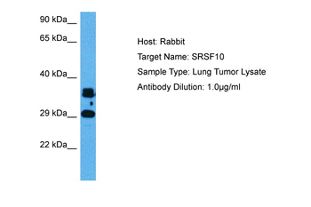 SRSF10 Rabbit Polyclonal Antibody