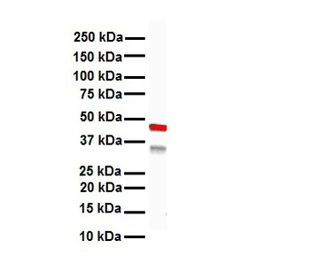 KRT15 Rabbit Polyclonal Antibody