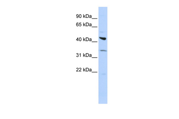 ADRB2 Rabbit Polyclonal Antibody