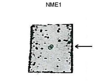 NME1 Rabbit Polyclonal Antibody