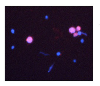 CASP3 Rabbit Polyclonal Antibody