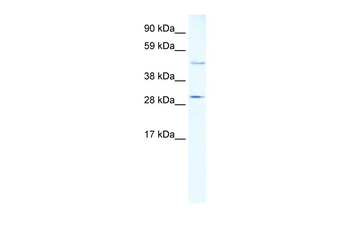 CASP3 Rabbit Polyclonal Antibody
