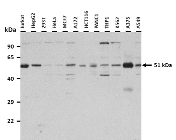 PLAGL1 Rabbit Polyclonal Antibody