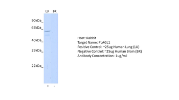 PLAGL1 Rabbit Polyclonal Antibody