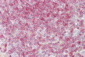 RIPK3 Rabbit Polyclonal Antibody