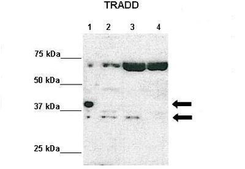 TRADD Rabbit Polyclonal Antibody