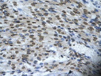 BAX Rabbit Polyclonal Antibody