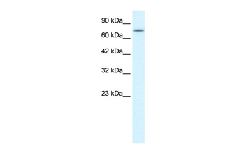 RIPK1 Rabbit Polyclonal Antibody