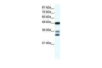 TNFSF10 Rabbit Polyclonal Antibody