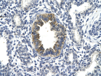 TP53 Rabbit Polyclonal Antibody