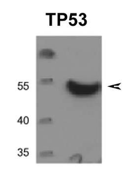 TP53 Rabbit Polyclonal Antibody
