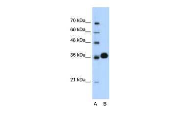 CDK6 Rabbit Polyclonal Antibody