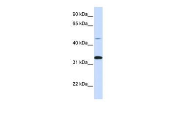 CDK3 Rabbit Polyclonal Antibody