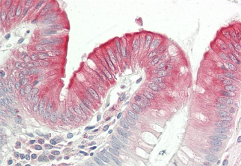 CDK5 Rabbit Polyclonal Antibody