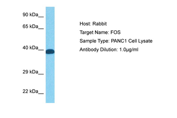 FOS Rabbit Polyclonal Antibody