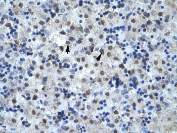 MAPK14 Rabbit Polyclonal Antibody