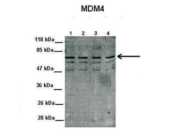 MDM4 Rabbit Polyclonal Antibody