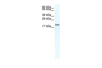 CXCL14 Rabbit Polyclonal Antibody