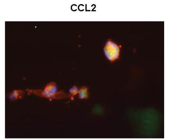CCL2 Rabbit Polyclonal Antibody