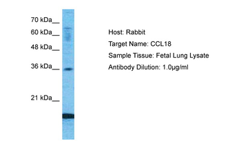 CCL18 Rabbit Polyclonal Antibody