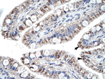 CCL18 Rabbit Polyclonal Antibody
