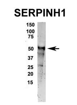 SERPINH1 Rabbit Polyclonal Antibody