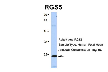 RGS5 Rabbit Polyclonal Antibody