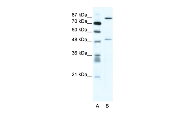 MMP10 Rabbit Polyclonal Antibody