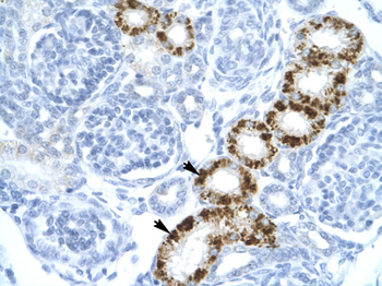 EIF2AK2 Rabbit Polyclonal Antibody