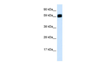 EIF2AK2 Rabbit Polyclonal Antibody